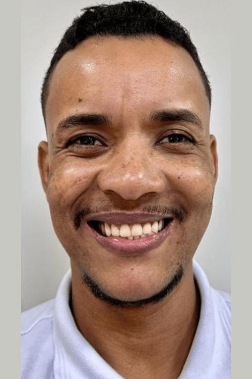 Dentes depois do tratamento