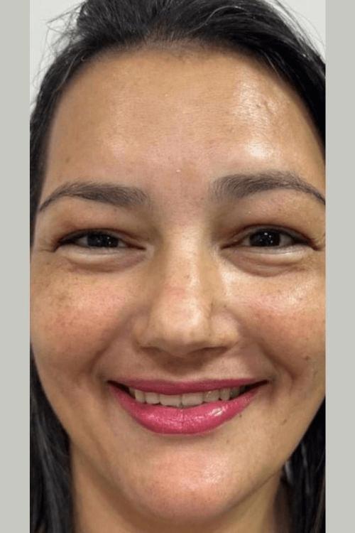 Dentes depois do tratamento