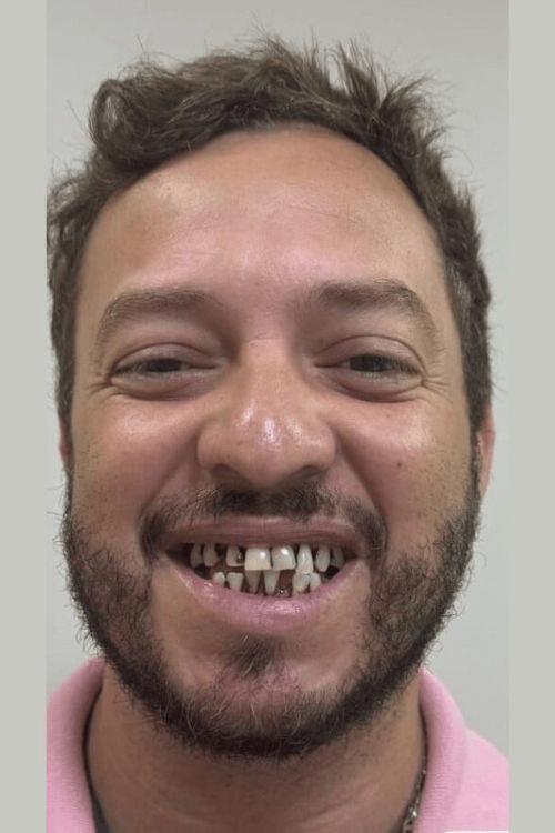 Sorriso antes do tratamento